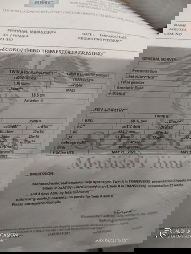 Naway manormal ko ang aking kambal
#teamMay
#Boy&Girl
#28weekers