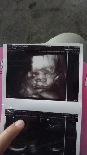 Bagaimana cara nambah berat badan Ade dan biar tidak sungsang