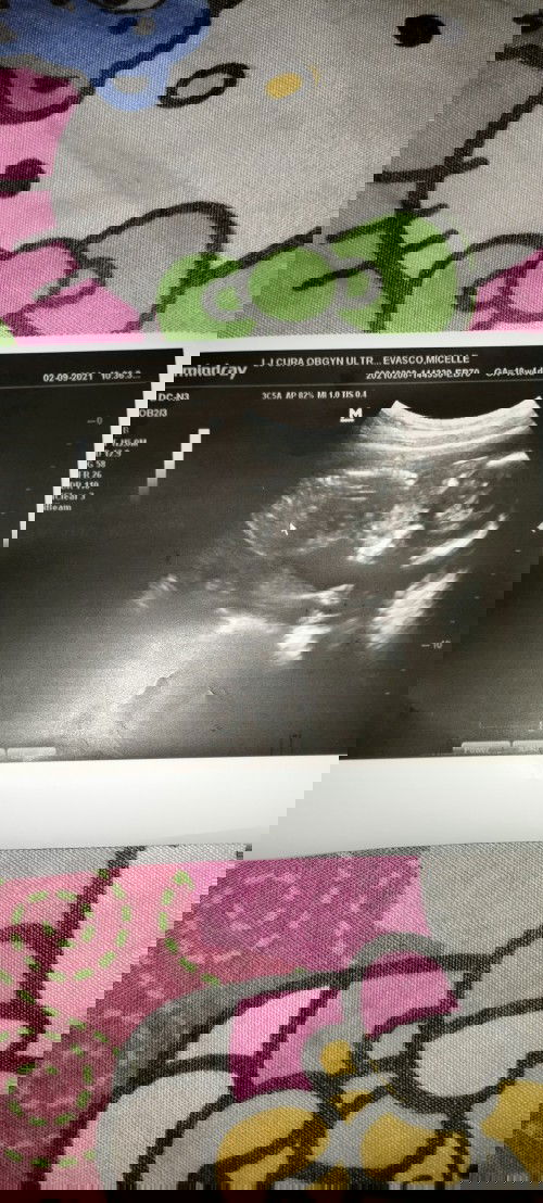 Any one can help me 
21 weeks of pregnant still no name for a baby boy