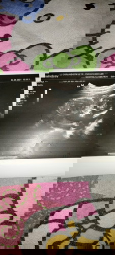 Any one can help me
21 weeks of pregnant still no name for a baby boy