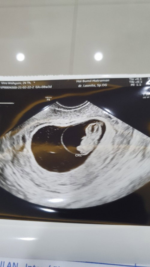 Bayi 😊😊😊😊