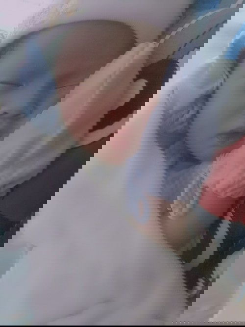 Bé nhà em đc 7ngay tuổi lúc về tới h bé hay bị đổ gèn 1 bên mắt hơi xưng cho e hỏi có sao ko ạ