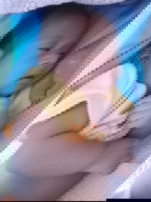 ลูกมีพังผืด