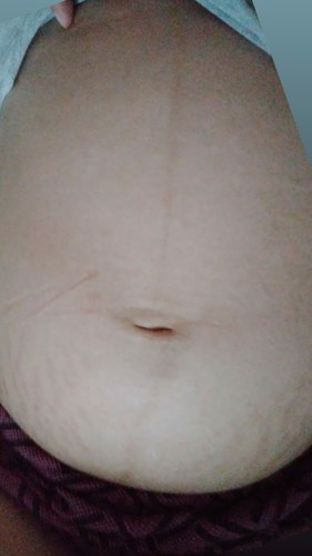 Pusod ng Buntis
