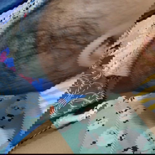 Kepala peyang belakang