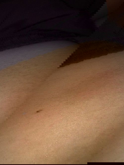 คันๆตรงท้องค่ะ