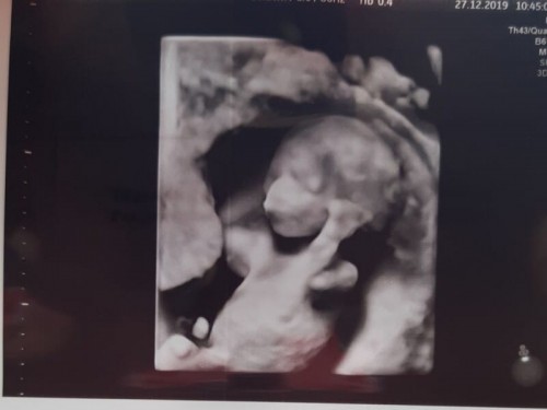 Anak 02.06.2020