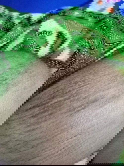 Kerak seperti ketombe