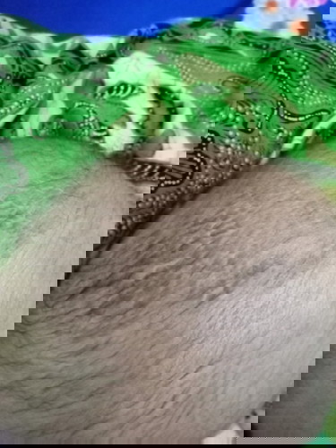 Kerak seperti ketombe