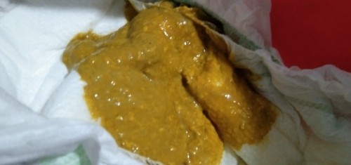 Baby Poop Similac tummicare user
