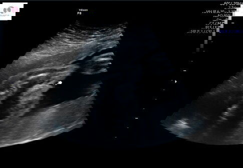 Ini jenis nya apa ya bun