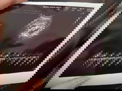 ไม่มีขั้นตอนไหนที่ง่ายเลย