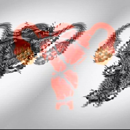 INFO ! Cramp perut@ari-ari sebelum period