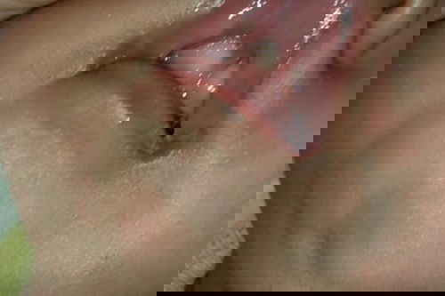 Bingung ini lip tie apa enggak