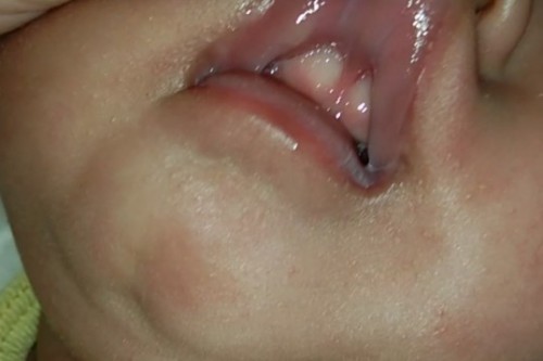 Bingung ini lip tie apa enggak