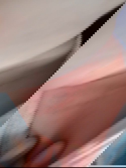 merah2 di leher bayi