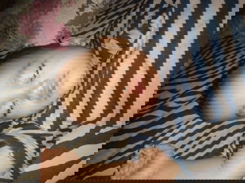 bibir bengkak abis jatuh