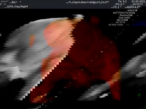 Usia kandungan 29 minggu