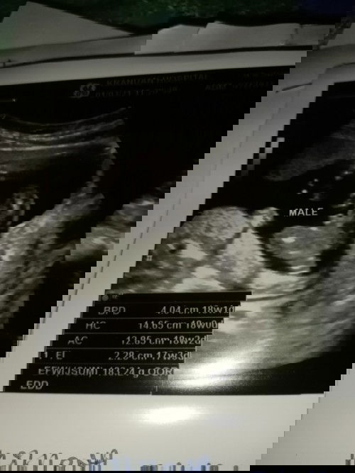 18+2ลูกชาย