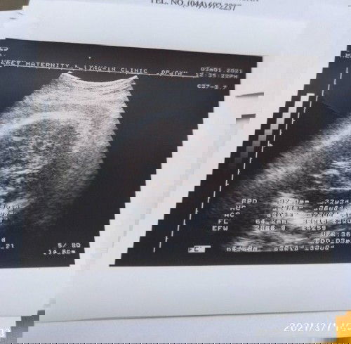 @35Weeks1Day CheckUp(01/03/2021)..😊