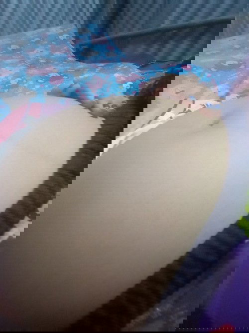 คุณแม่ท่านไหนพอทราบบ้างคะคือเจ็บตรงหัวโค้งระวังขาสองข้างจะเป็นไรไหมค่ะ