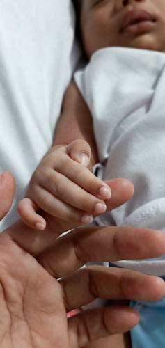 #daliri
Normal po ba ung dark color sa daliri dun malapit sa kuko ni baby ??