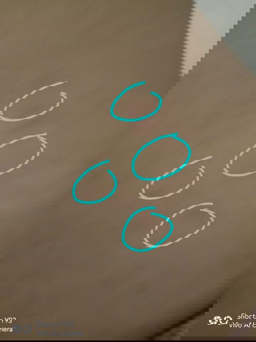 Usia kandungan saya 22 week tp kenapa muncul bintik" merah di kulit saya dok, ini faktor ap penyebab