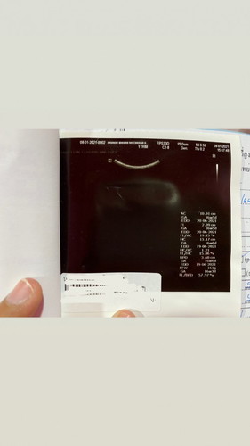 ขอสอบถามหน่อยคะแม่ๆ