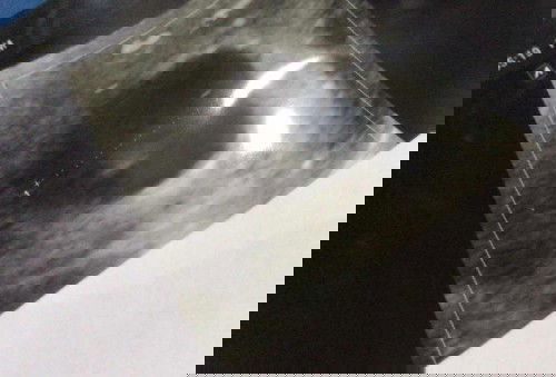 Flek dan Pendarahan tapi calon debay aman