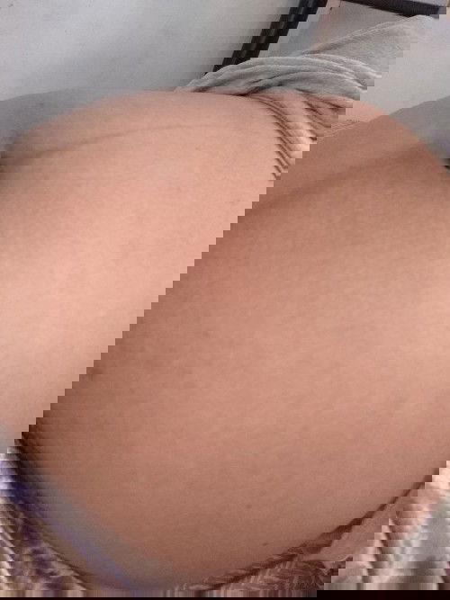 Belly Bump Rash Problem