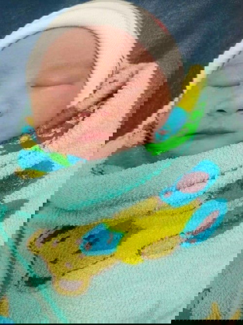 คลอดแล้วนะค่ะ ผ่าคลอดวันที่24/2/64