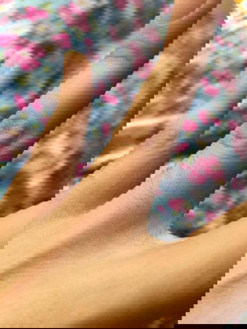 ruam ruam sekitar jari