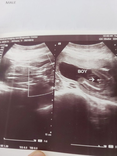 It's a boy! Hihihihi