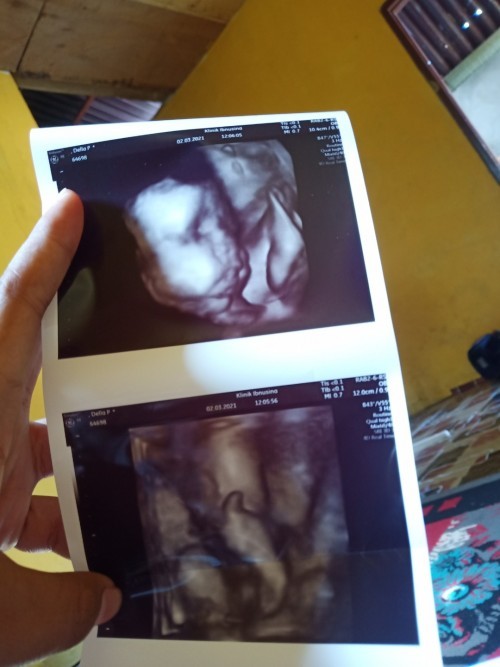 Berat badan janin Kehamilan 29week