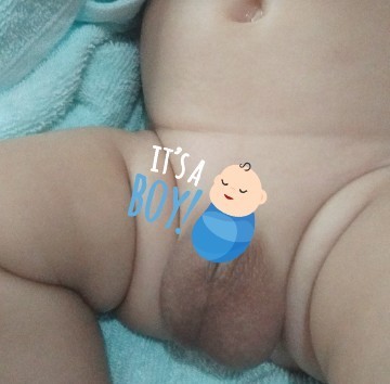 Testis baby