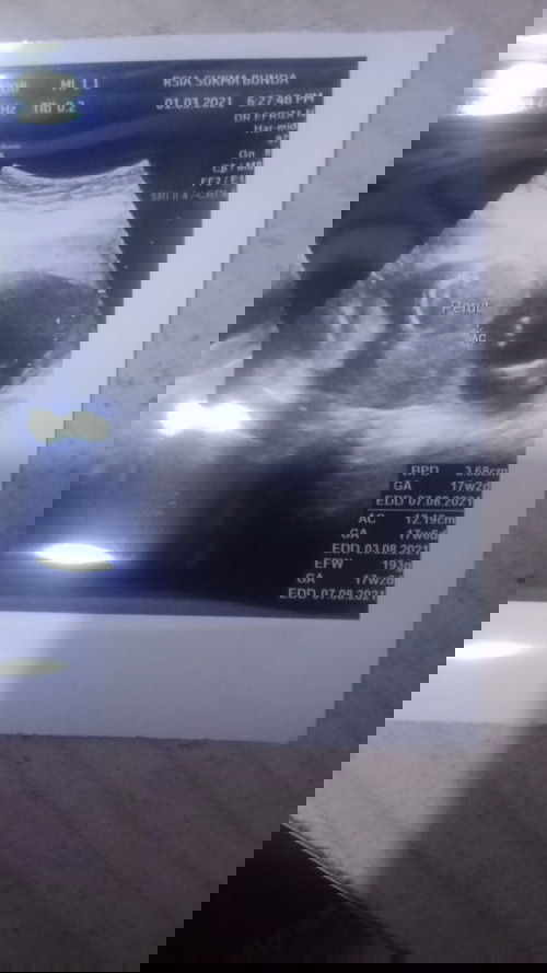 Berat badan gak naik