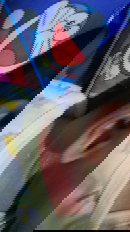 Lipatan di leher merah