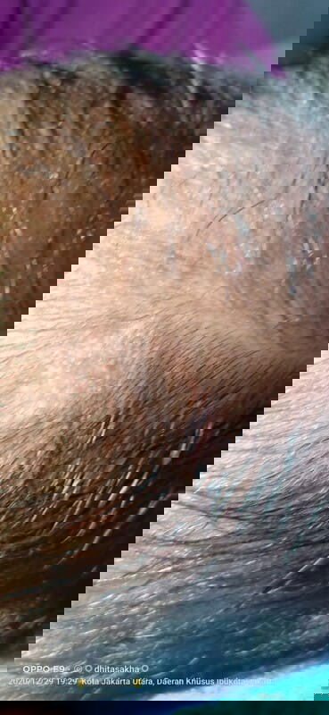 Bismillah..bun..mau tanya ada yg punya pengalaman seperti sy ngk ada bulatan di kepala bayi newborn