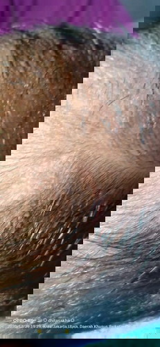 Bismillah..bun..mau tanya ada yg punya pengalaman seperti sy ngk ada bulatan di kepala bayi newborn