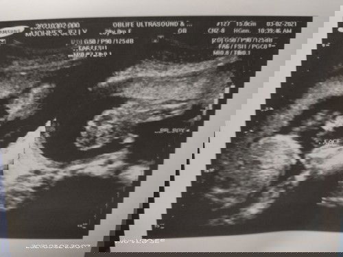 ITS A BOY 
suggest naman mga momsh maganda name ky baby☺️