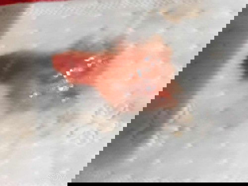 สอบถามใครเคยเป็นบ้าง