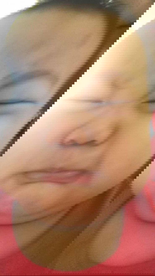 ฉีดวัคซีนมา ตั้งขาตรงไม่ได้