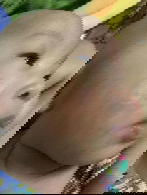 ผื่นแดงใช้ครีมทาตัวไหนกันบ้างคะ