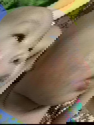 ผื่นแดงใช้ครีมทาตัวไหนกันบ้างคะ