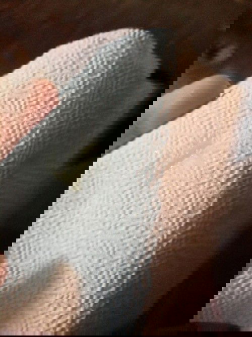 แม่ๆแบบนี้คืออะไรค่ะกำลังไปปัสสาวะ​ในห้องน้ำ​ เราจับน้องสาวดูมันก็มีใอ้นี้ออกมาค่ะ​ 29w3วัน