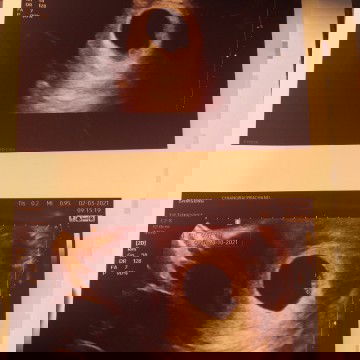 ขออนุญาตสอบถามแม่ๆนะคะ