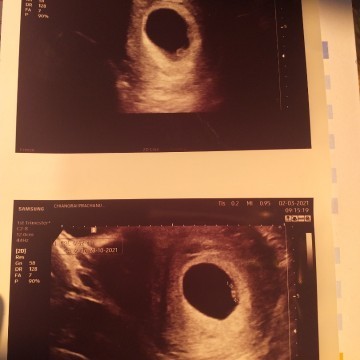 ขออนุญาตสอบถามแม่ๆนะคะ