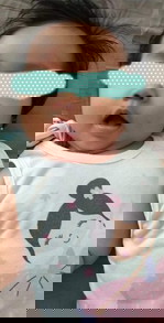 Kagat ng lamok, kagat po ba to ng lamok?