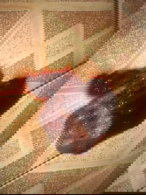 Keluar gumpalan apa ini kantung janin?