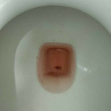 Hi po mga mamii may question lang po ako FIRST TIME ko po mag buntis.